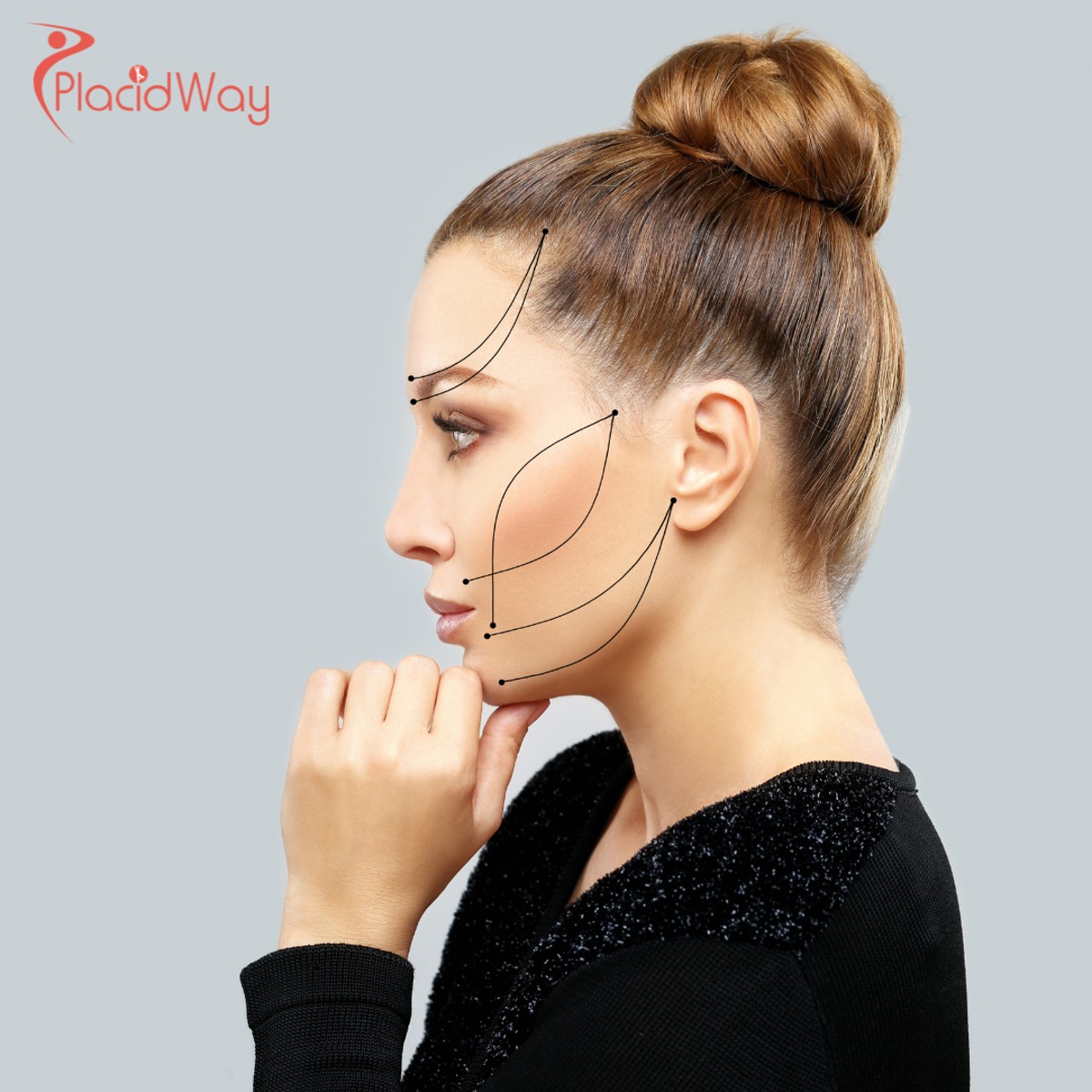 Facelift Surgery in Turkey: How German Patients Achieve Youthful Looks with Rhytidectomy