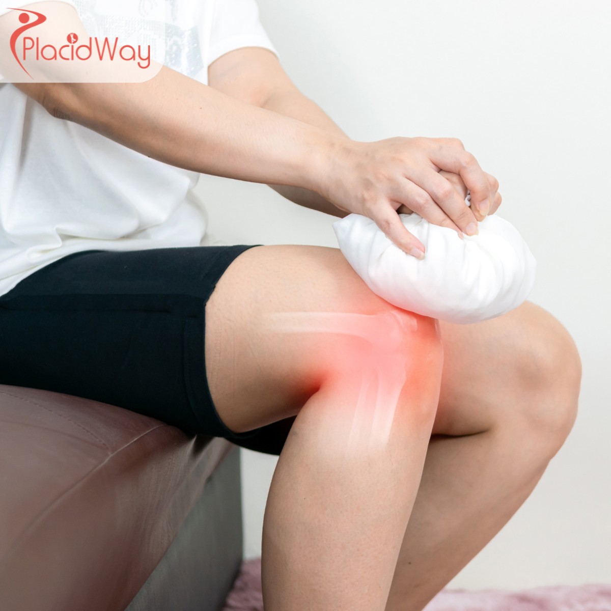 Stem Cell Therapy for Osteoarthritis in Turkey: Costs and Options for UK Patients