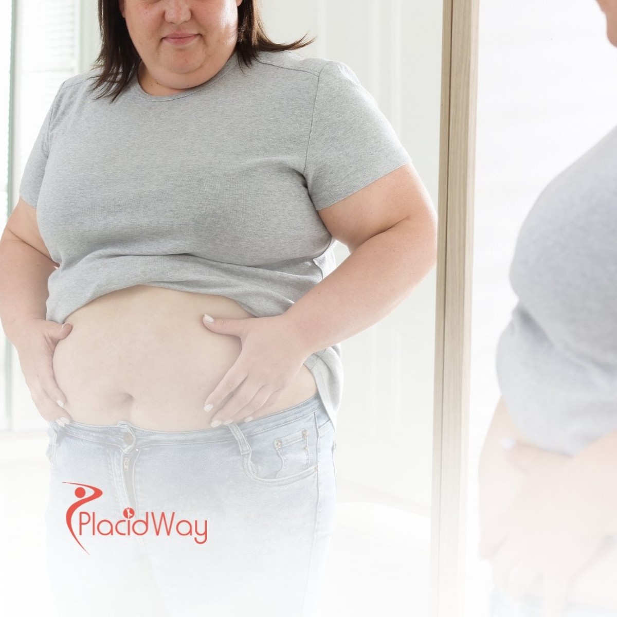 Bariatric Surgery in Cancún, Mexico: The Top Weight Loss Solution for Florida Residents