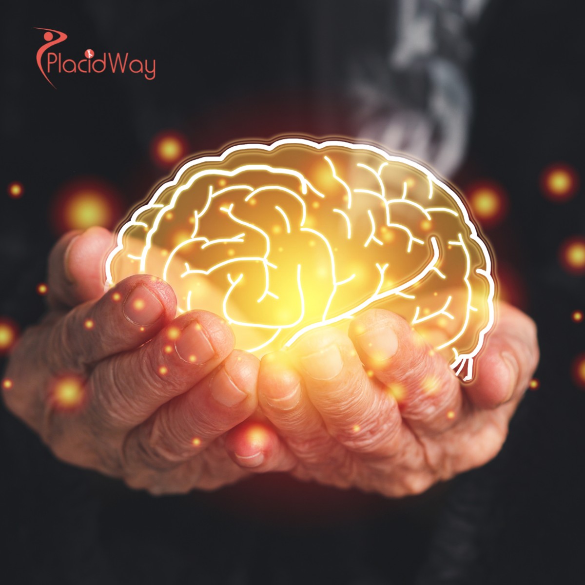 Stem Cell Therapy for Neurological Disorders in Slovakia: A Comprehensive Guide