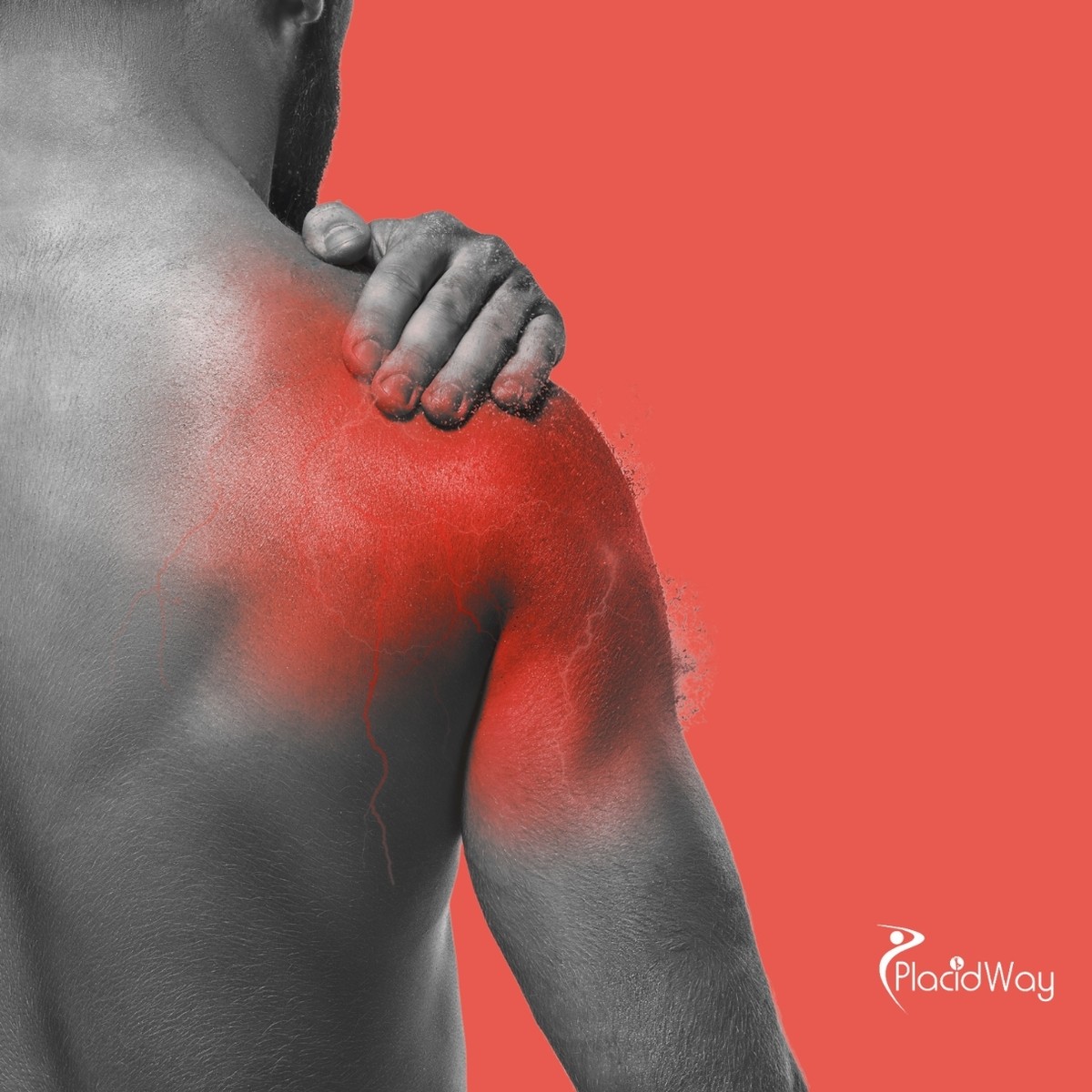 Restoring Shoulder Mobility: A Berlin Patient’s Guide to Stem Cell Therapy in Greece