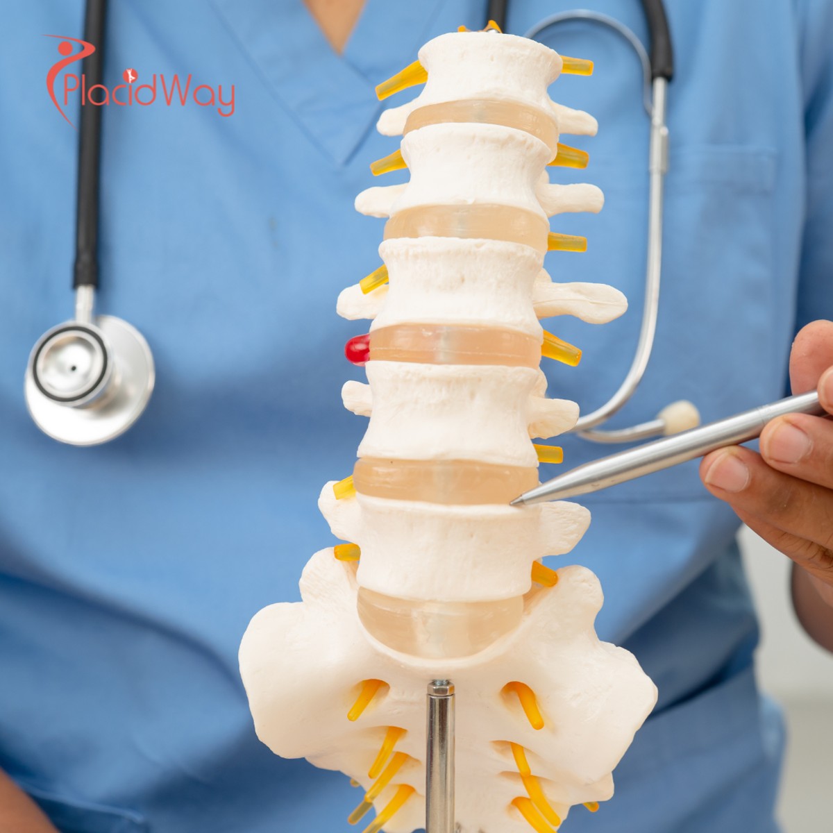 Affordable Stem Cell Therapy for Spinal Cord Injury in India: A Comprehensive Patient Guide