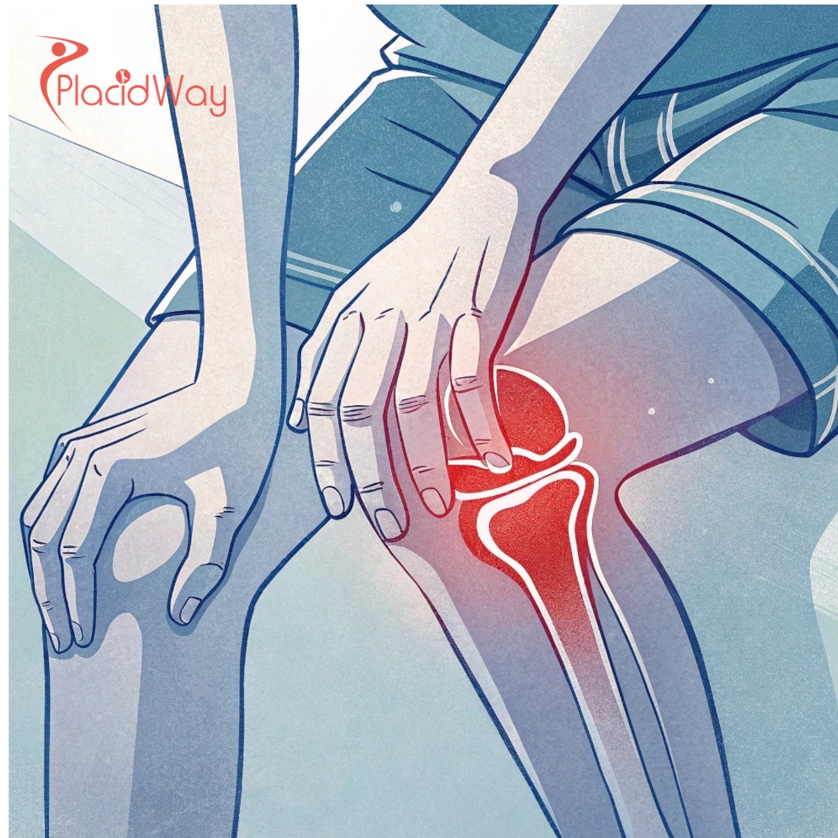 Stem Cell Therapy for Knee Pain in India: A Complete Guide