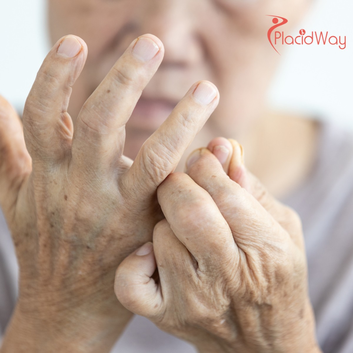 Stem Cell Therapy for Rheumatoid Arthritis in India: A Guide to Costs & Care