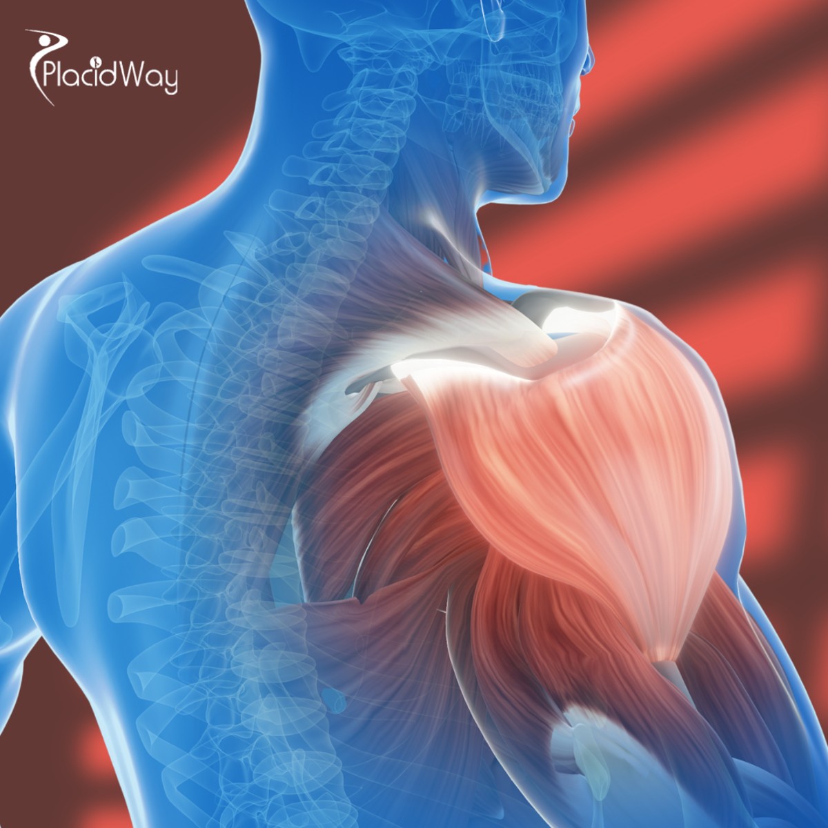 Rotator Cuff Tear Stem Cell Therapy in the Dominican Republic for Patients from Canada Looking to Regain Strength