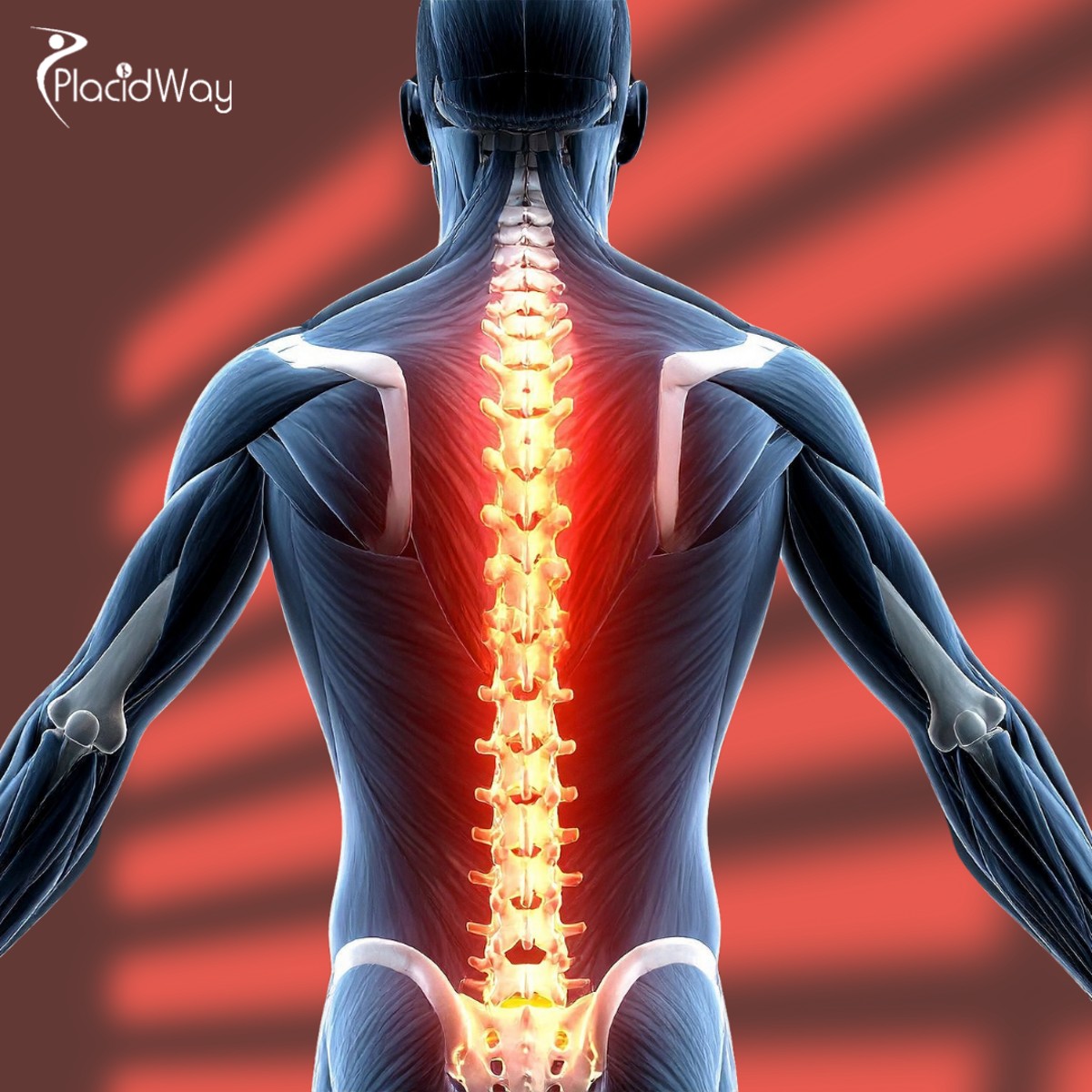 Rise Beyond Limits: Spinal Cord Injury Stem Cell Therapy in Malaysia Giving Hope to Patients from India