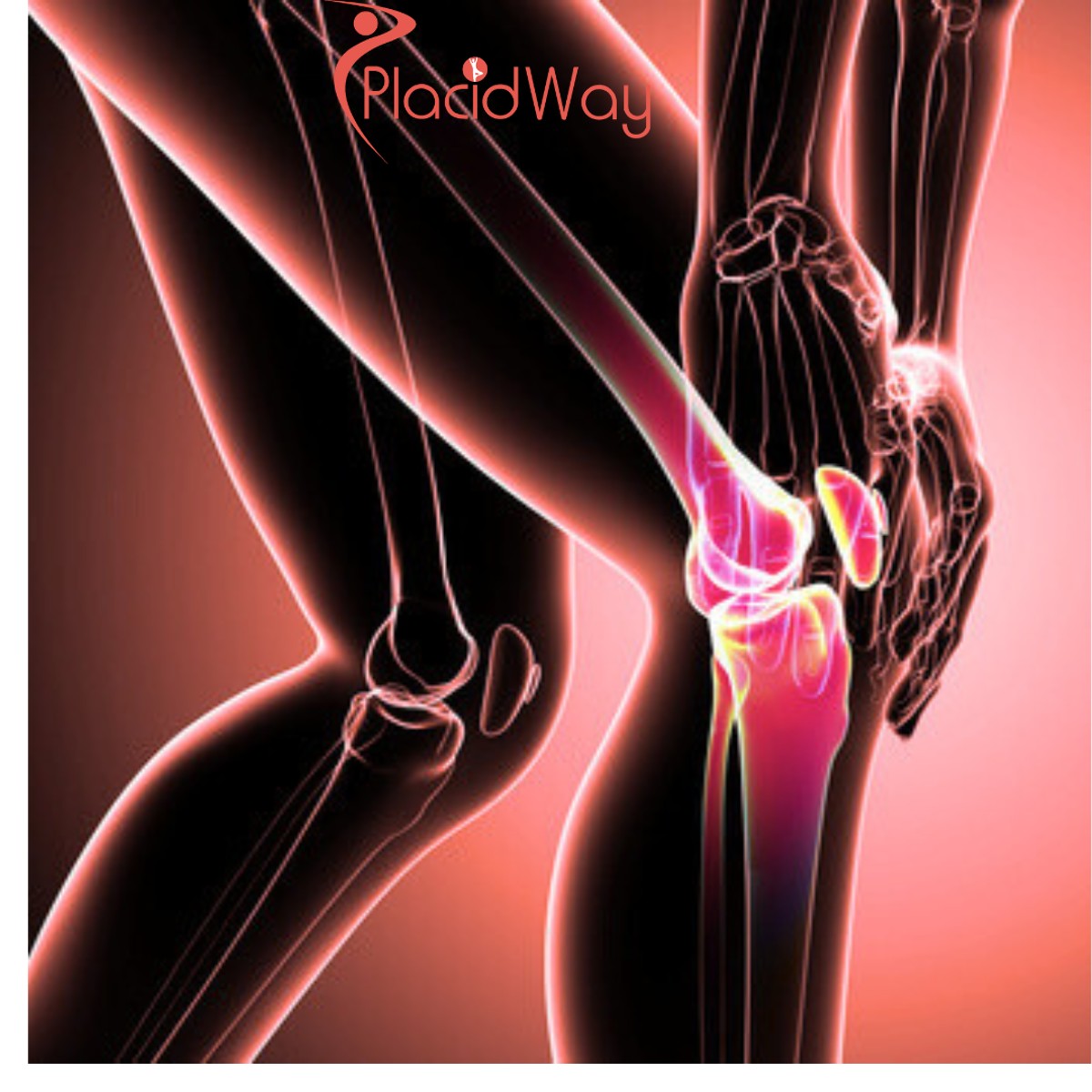 Stem Cell Treatment for Knee Pain in Japan for American Patients