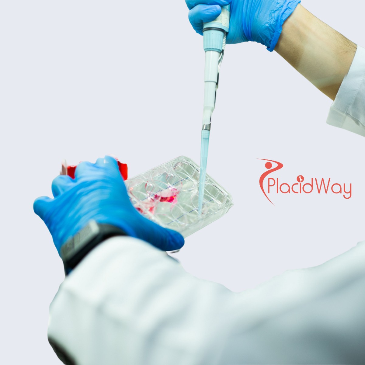 Regenerative Stem Cell Therapy in Colombia for German Patients from Hamburg