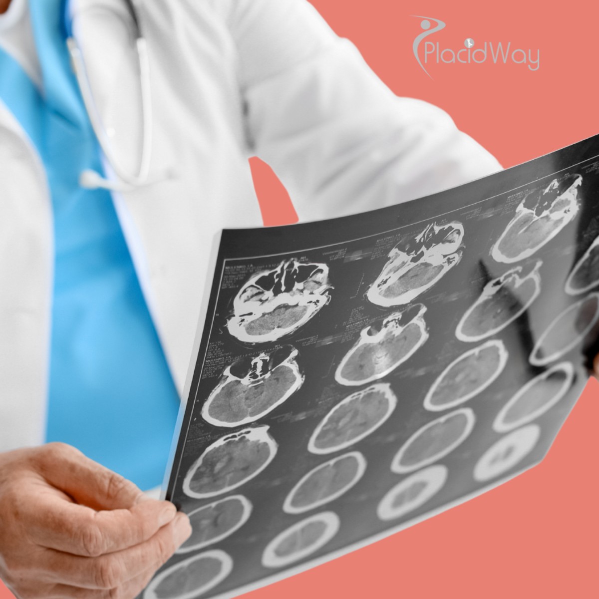 Ibogaine Treatment Considerations for Traumatic Brain Injury (TBI) Recovery in Mexico