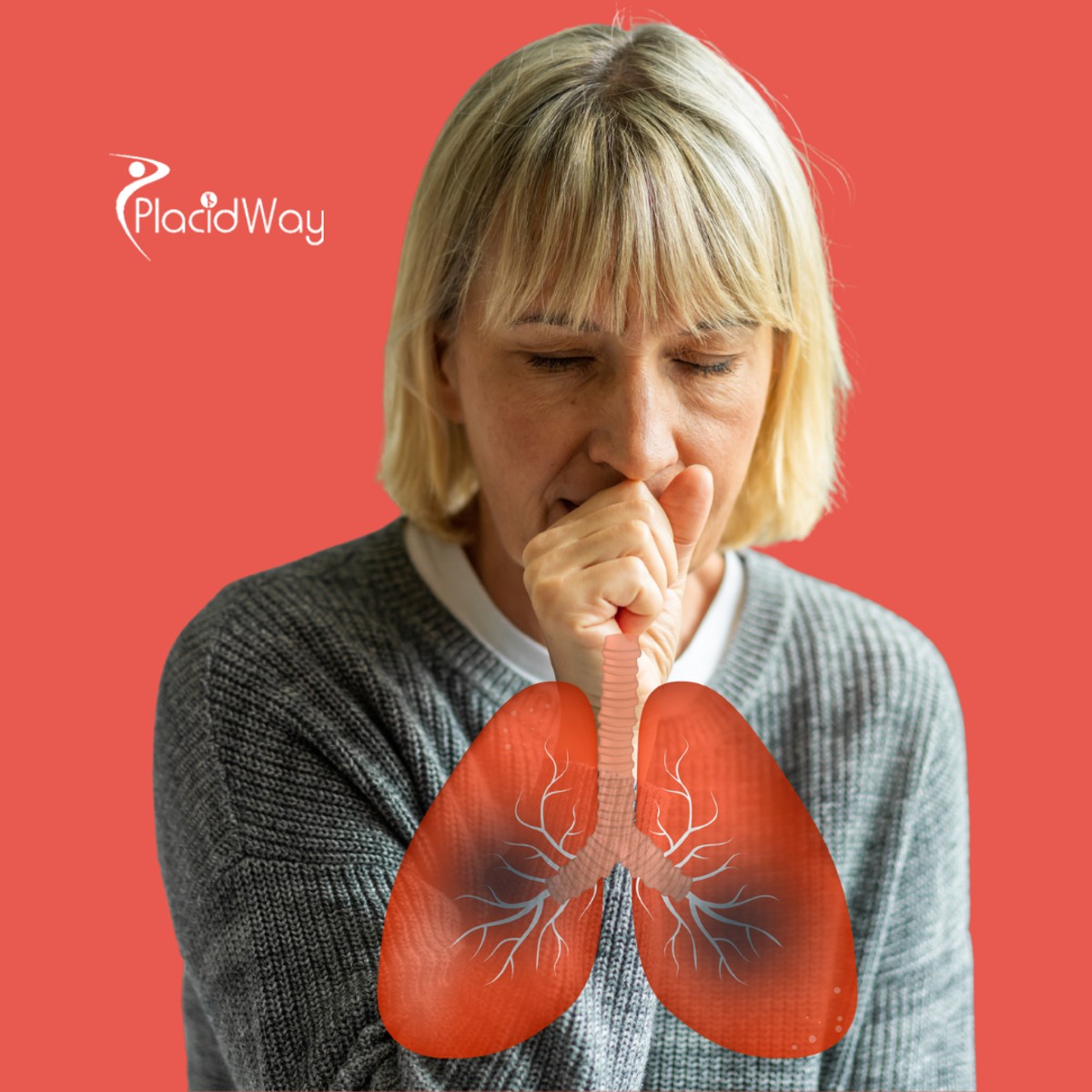 Lung Cancer Treatment in Mexico: Immune and Alternative Therapies 