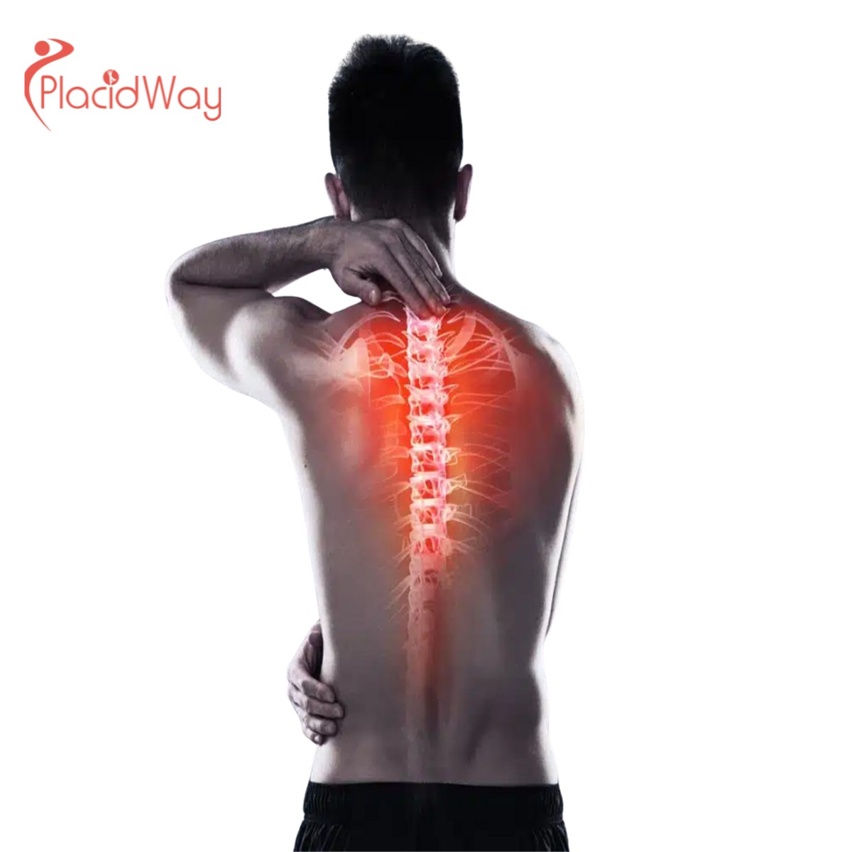 6 Reasons to Choose Spine Surgery in Warsaw, Poland