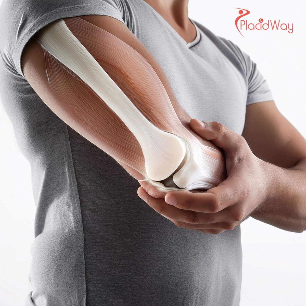 German Engineering Meets Biological Innovation: High-Tech Joint Repair at Cell Center Slovakia