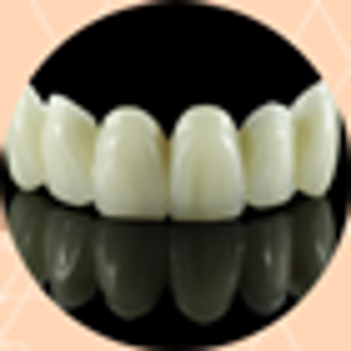 Guide to Best Dental Veneers in Istanbul, Turkey 