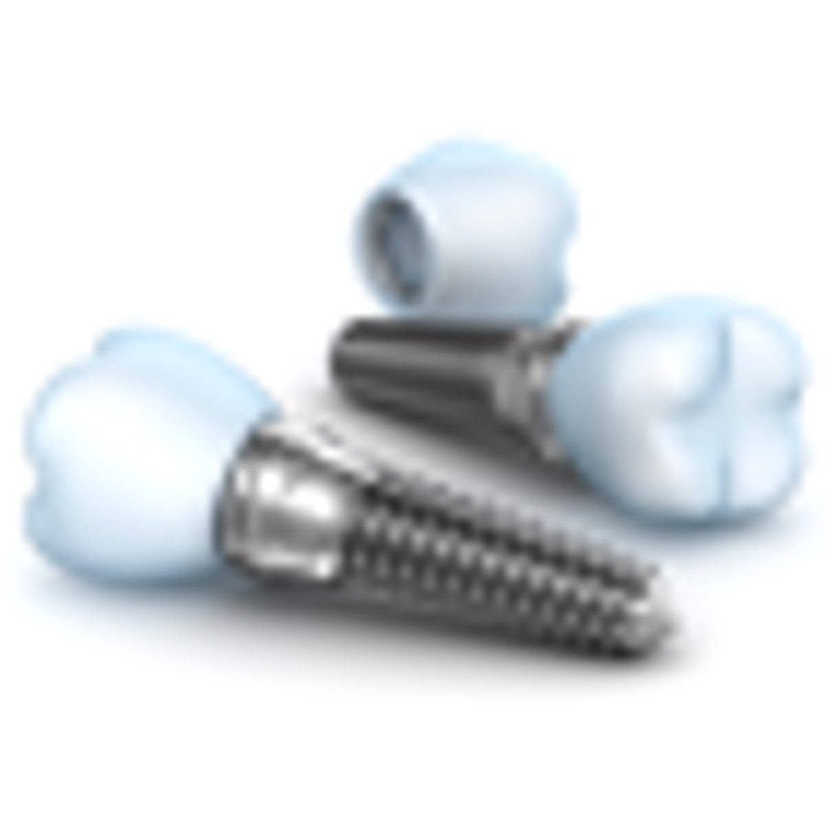Educate Yourself Before Dental implants in Abu Dhabi