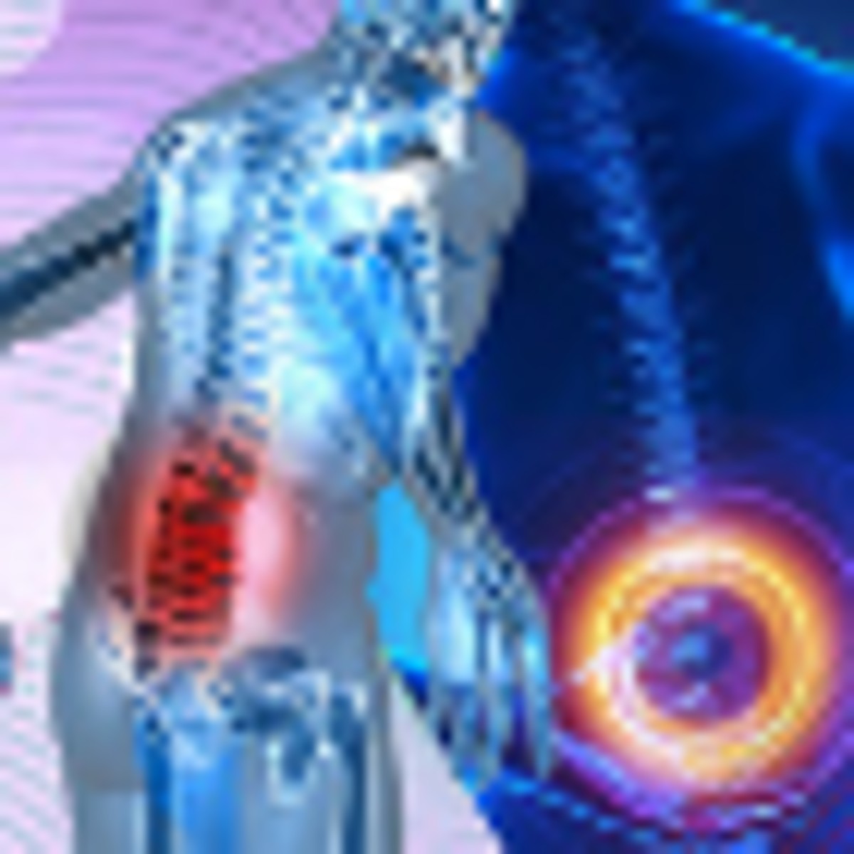 Learn About Spinal Stenosis in Puerto Vallarta, Mexico