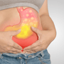 Gastric Bypass Surgery Package in Tijuana, Mexico at Low Cost thumbnail