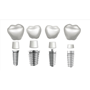 All on 4 Dental Implants in Puerto Vallarta, Mexico thumbnail