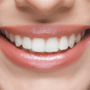 All on 4 Dental Implants Package in Cancun, Mexico thumbnail