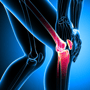 Radiofrequency Ablation for Spine & Knee Pain at Istanbul, Turkey  thumbnail