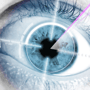 Cataract Femtosecond Laser Surgery in Italy thumbnail