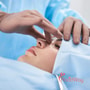 Precision Rhinoplasty Package in Tijuana, Mexico by Dr. Israel Villalobos thumbnail