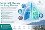 Stem Cell Therapy for Lung Disease  thumbnail