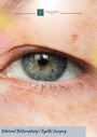 Bilateral Blefaroplasty (Eyelid) Surgery thumbnail