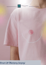 Breast Lift (Mastopexy Surgery)  thumbnail