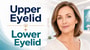 Upper Eyelid and Lower Eyelid thumbnail