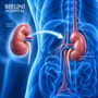 Kidney Transplant Package in Istanbul Turkey by Biruni Hospital thumbnail