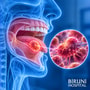 Oral Cancer Treatment Package in Istanbul Turkey by Biruni Hospital thumbnail