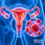 Uterine Cancer Treatment Package in Istanbul Turkey by Biruni Hospital thumbnail