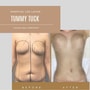 Cheapest Package for Tummy Tuck in Reynosa, Mexico - $3,700 thumbnail