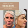 Face Lift Package in Reynosa, Mexico by Hospital Los Lagos thumbnail