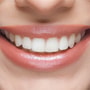Full Mouth-All in 4 - All in 6 Dental Implant Package in Istanbul, Turkey thumbnail