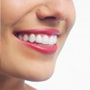 Smile Makeover Package by Bergedent Clinic in Istanbul, Turkey thumbnail