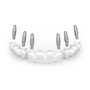 All on 6 Dental Implants Package in Los Algodones, Mexico thumbnail