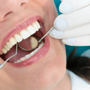 High Quality Dental Fillings Package in Los Algodones Mexico thumbnail