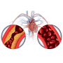 HICC Brings the Best Life-Saving Chelation Therapy in Makati, Philippines thumbnail