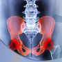 Top 10 Options for Successful Hip Replacement Surgery in Asia thumbnail