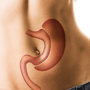 Gastric Sleeve Package in Istanbul, Turkey by Estpoint thumbnail