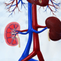 Stem Cell Therapy Package for Kidney Failure in Mexico thumbnail