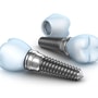 Affordable Package for Dental Implants in Antalya, Turkey thumbnail