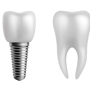 Affordable Package for Dental Implants in Zagreb, Croatia thumbnail