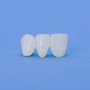 Popular Package for Dental Crowns in Istanbul, Turkey thumbnail