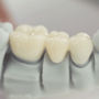 Davinci Top Dental Crowns in San Jose Costa Rica thumbnail