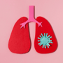 Price Comparison for Stem Cell Therapy for COPD in Mexico thumbnail