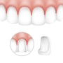 Popular Package for Dental Veneers in Medellin, Colombia thumbnail