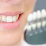 Affordable Package for Dental Veneers in Turkey thumbnail