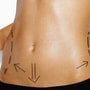 Affordable Package for Liposuction by Gastelum in Tijuana, Mexico thumbnail